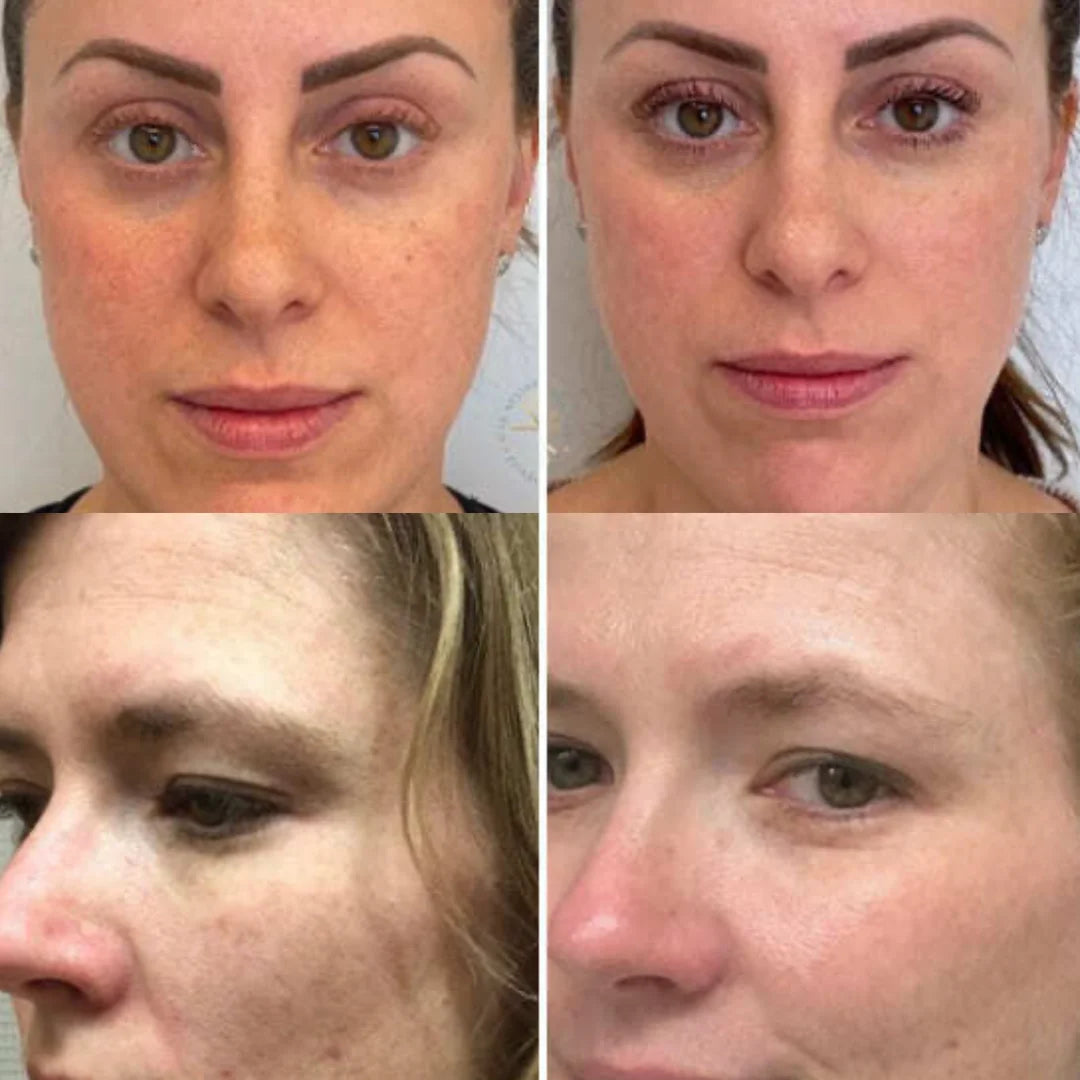 Sérum raffermissant anti-rides au venin d'abeille SADOER CI