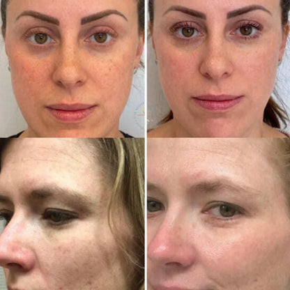 Sérum raffermissant anti-rides au venin d'abeille SADOER CI